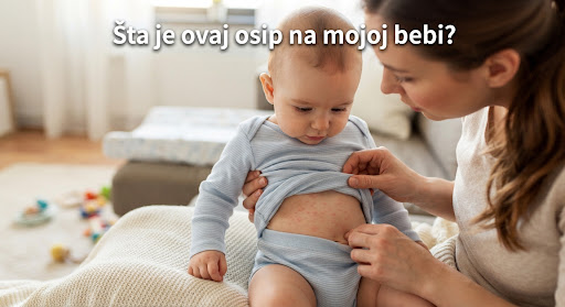 Šta je ovaj osip na mojoj bebi?